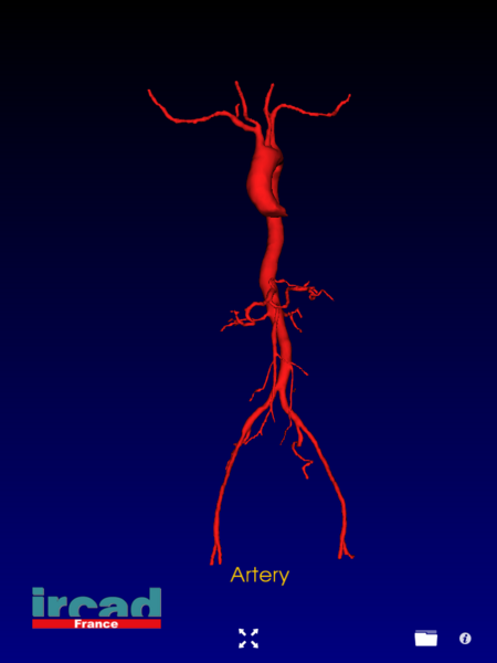 File:Ircad artery.PNG